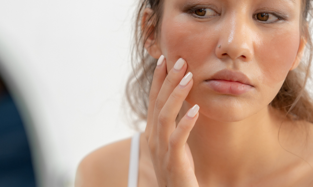 Iss dich gesund bei Rosacea und lass deine Lebensmittel deine Heilmittel sein!