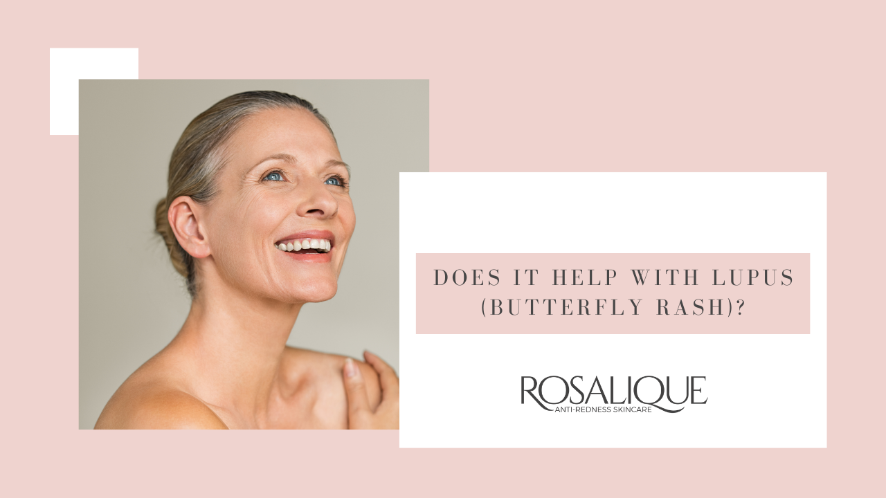 Hilft Rosalique bei Lupus (Hauttuberkulose)?